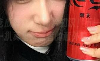 最新冷知识！五一吃瓜群众扒一扒莫里秀患者的意外真实反应！